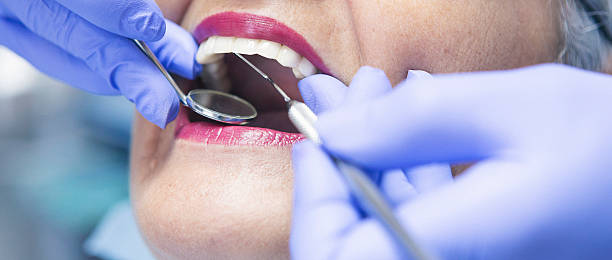 Best Dentist for Tooth Abscess  in Vandalia, MO